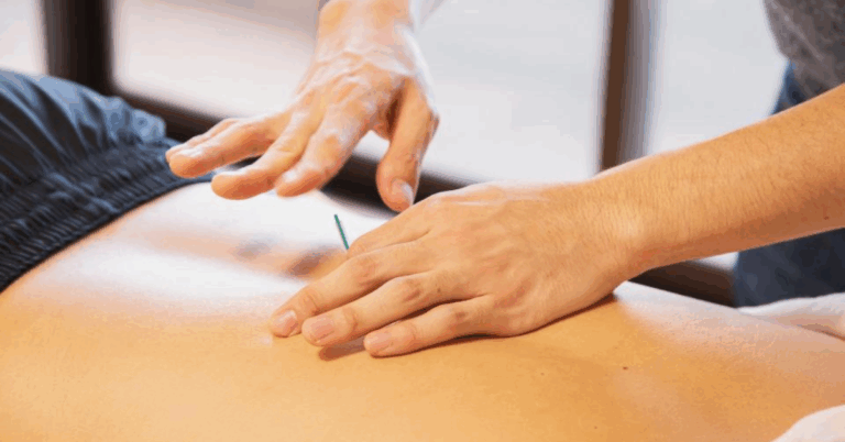 Best TCM Acupuncture: A Comprehensive Guide to Healing and Harmony